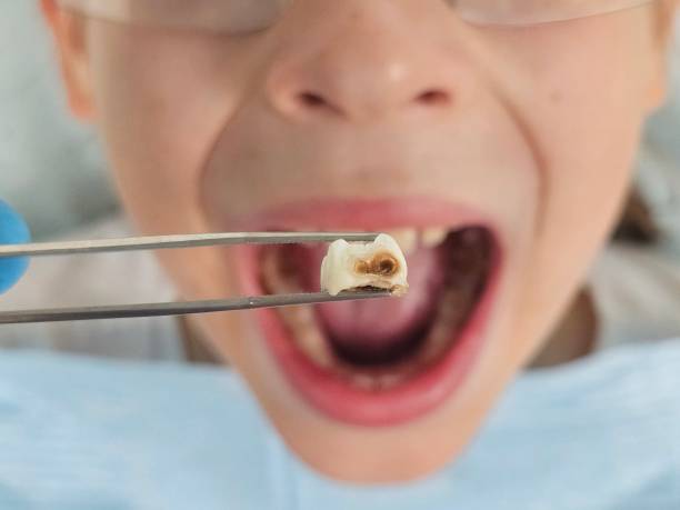 Best Knocked-Out Tooth Emergency  in Gorman, NC