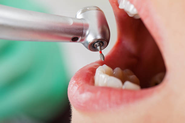 Best Emergency Gum Pain Relief  in Gorman, NC